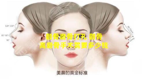 颧骨磨骨打孔 颧骨高磨骨手术需要多少钱